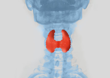 acupuncture treatment for thyroid disorders disorders in hyderabad